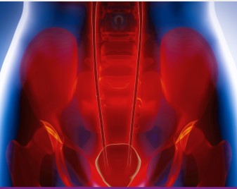 Hands-on: Chronic Pelvic Pain in Women: Assessment, Diagnosis, Innovative Treatments Banner